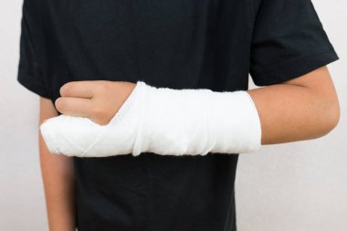 Eli bandajlı bir genç. Kırık kol. Kırık bacaklı bir çocuk. Yaz tatilinde kırık. Parmaklar alçıda..