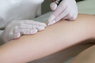 Kuaförde kadın bacaklarının elektriklenmesi.