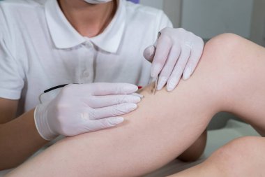 Kuaförde kadın bacaklarının elektriklenmesi.