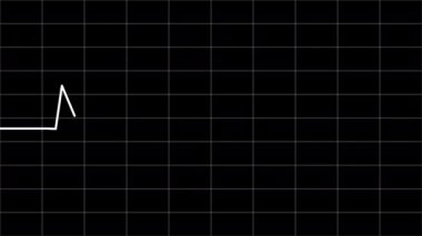 Elektrokardiyogram nabız kusursuz döngü arkaplanı