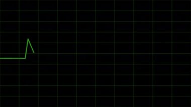 Heartbeat Medical Cardiogram Animation,Heartbeat green animation