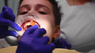 Close-up of the child at the pediatric dentist appointment, with retractor in mouth, while the doctor collects water and saliva using saliva ejector during dental treatment in modern dentistry clinic