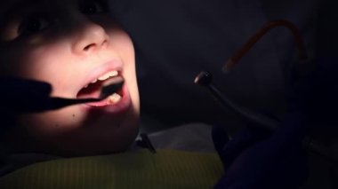 Close-up. Face of a patient in dentistry clinic, a child boy with open mouth while dentist using dental turbine, spraying water in oral cavity and examining teeth with dental mirror. Dental practice