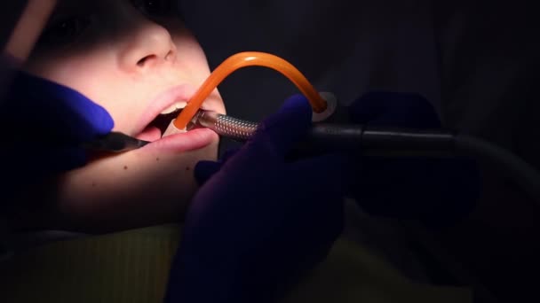 Cropped View Childs Face Open Mouth Teeth Treatment Dentist Dentist — Stock Video