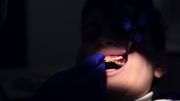 Close Dentist Applying Anesthetic Childs Gum Extracting Molar Baby Teeth — Stockvideo