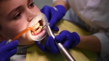 Close-up of a teenage boy with retractor in mouth, sitting on dentists chair and having professional dental cleaning or polishing, in modern pediatric dentistry clinic. Using saliva ejector