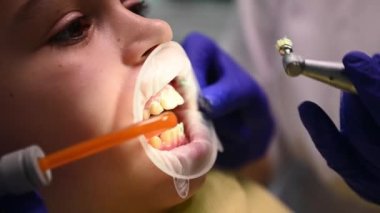 Close-up side view. Detail: dentist doctor doing professional cleaning dental plaque and polishing childs teeth, using a dental handpiece polishing brush at stomatology clinic. Pediatric dentistry