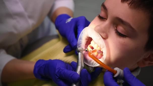 Крупный Подросток Стоматологическом Осмотре Мальчик Проходит Процедуру Отбеливания Зубов Стоматолог — стоковое видео
