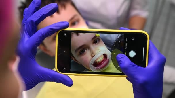 トップビュー歯科医の手は 口の中でリトラクターと10代の男の子に行わプロの歯の洗浄と研磨の結果を撮影し ライブビューモードで現代的なスマートフォンを保持しています 小児科 — ストック動画