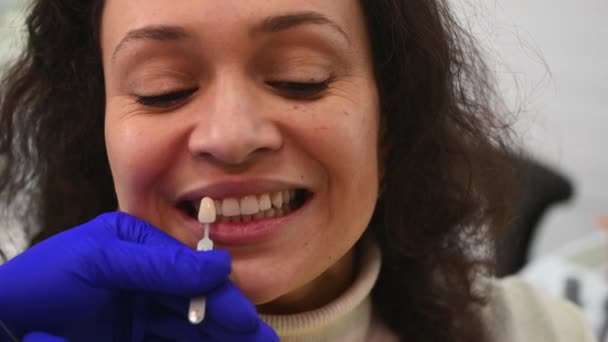 特写女性的脸 微笑着笑着 而医生牙医正牙医生 使用一个牙齿颜色图表 根据维塔比例尺选择牙齿的阴影 供应商的颜色选择 — 图库视频影像