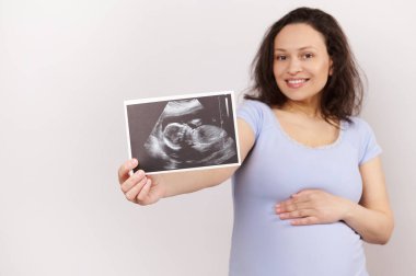 Ultrason görüntüsüne seçici odaklanma, gülümseyen, hamile bir kadının elinde doğan bebek sonografisi, karnına dokunmak, olumlu duygular ifade etmek, beyaz arka planda izole edilmiş.
