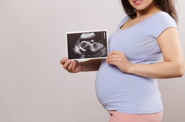 Hamile, gülümseyen bir kadının karnı, müstakbel bebeğinin ultrason görüntüsünü tutan hamile bir anne, izole edilmiş bir arka planda. Hamilelik. Çocuk doğurmak. Beklenti. Annelik