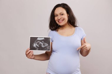 Anne karnında çocuğunun tomografisini tutan, kameraya gülümseyen, karnını işaret eden, hamileliğinin ve anneliğinin olumlu anlarını yaşayan, izole edilmiş bir geçmişi olan mutlu hamile bir anne.