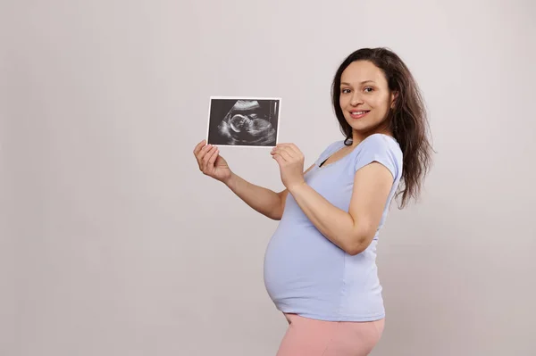 stock image Side portrait of a happy attractive woman, expectant pregnant gravid mother smiling and showing at camera the ultrasound scan image of her future baby, isolated background. Pregnancy. Expecting a baby