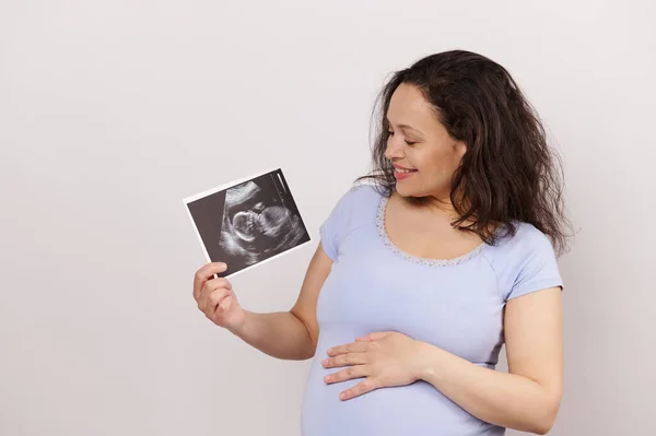 stock image Portrait of a happy pregnant woman touching belly, holding ultrasonography of her baby, isolated white background. Excited amazed gravid female expecting baby. Ultrasound diagnostics during pregnancy