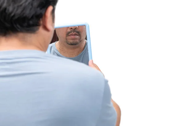 Γενειοφόρος Άντρας Που Κοιτάζει Στον Καθρέφτη Για Δερματικές Ετικέτες Ακροχορδόνες — Φωτογραφία Αρχείου