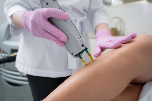 Laserové Odstranění Chloupků Nohách Dívky Kosmetické Klinice — Stock fotografie
