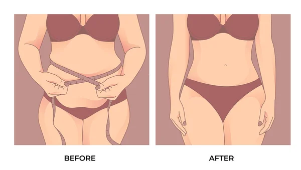 Bauchfett Vor Und Nach Der Gewichtsabnahme Transformation Der Weiblichen Körperform — Stockvektor