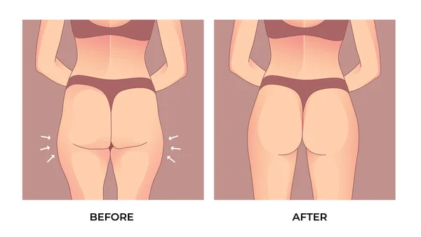 Stehenní Tuk Před Hubnutí Žena Transformace Tvaru Těla Fat Fit — Stockový vektor