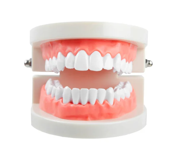 Närbild Tänder Modell Med Rött Tuggummi Vit Bakgrund Spara Klippning — Stockfoto