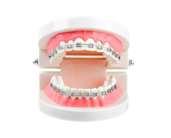 Modelo Dentes Com Fio Metal Aparelho Dentário Instrumentos Dentários Isolados — Fotografia de Stock