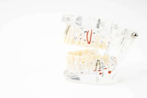 Model Stomatologiczny Obudowa Oraz Zęby Protezy Ludzkie Białym Tle — Zdjęcie stockowe