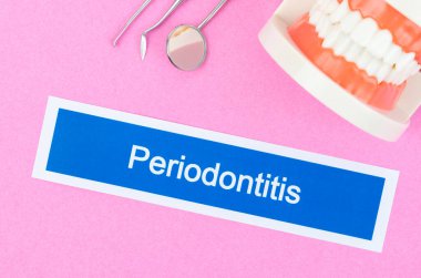 Pembe arka planda Periodontit diş hastalığı olan diş modeli.