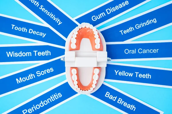 Modelo Prótesis Con Enfermedad Dental Sobre Fondo Azul — Foto de Stock