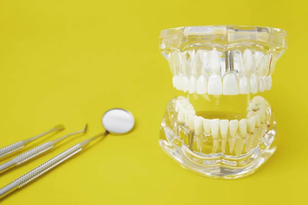 Dentes Modelo Instrumento Dental Fundo Amarelo — Fotografia de Stock