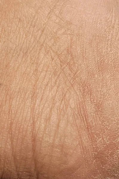 close - up of skin and veins of the skin of an old woman with a veins.