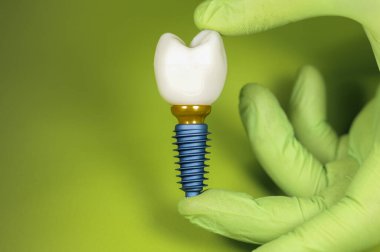 Yeşil arka planda implant