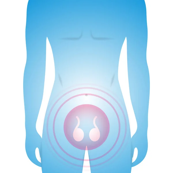 Silhueta Masculina Mostrando Testículos Problema Sistema Reprodutivo Deficiência Testosterona Ilustração —  Vetores de Stock