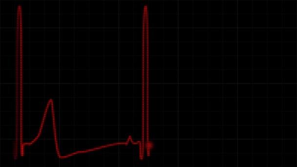 心跳平缓 无孔不入的循环动画 筛选细胞或像素效果 带栅格的黑色背景上的脉迹红线 — 图库视频影像