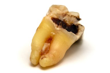 Beyaz arka planda izole edilmiş yirmilik dişi, yakın plan makro çekim. Sekiz numaralı diş, son derece detaylı bir fotoğraf.