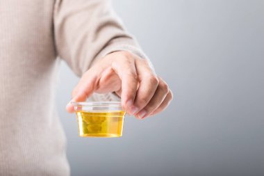 Bir adam idrar örneğini içeren temiz bir plastik bardak tutuyor ve idrar renginin önemli sağlık bilgilerini nasıl ortaya çıkardığını vurguluyor. Sağlığın korunmasında kendini izlemenin rolünün bir hatırlatıcısı.