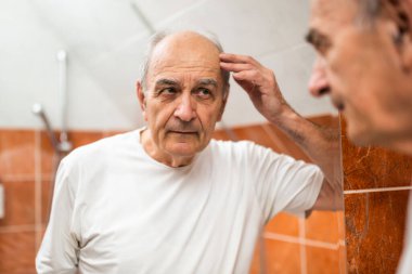 Yaşlı adam aynanın önünde kel kafasına dokunurken kaşlarını çatıyor. Saç dökülmesinden dolayı üzüntü belirtileri gösteriyor..