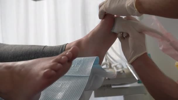 Orthopedist Gloves Scanning Patients Feet Laser Control Conditions Nerves Bones — Wideo stockowe