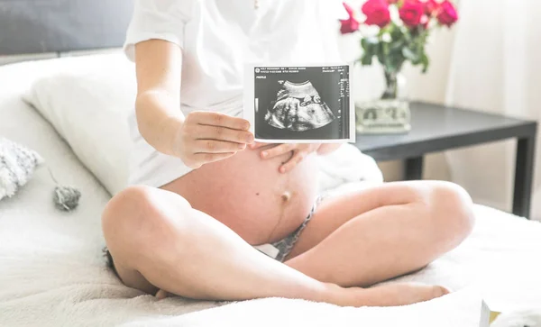Terhes Ágyon Kezében Egy Röntgenkép Babáját Koncepció Terhesség Anyaság Szülés — Stock Fotó