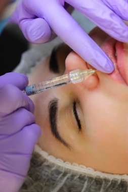 Kozmetik prosedürü. Bir kadın için dudak büyütme işlemi. Bir kozmetolog tıbbi maske takıyor, mor lastik eldivenler dudaklarına hyaluronik asit bazlı dolgu yapıyor. Güzellik enjeksiyon süreci.