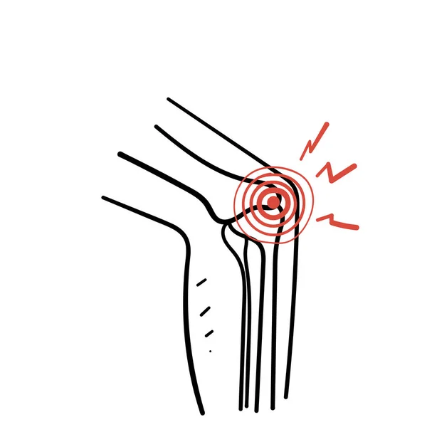 Handgezeichnete Doodle Knochengelenkschmerzen Illustration — Stockvektor