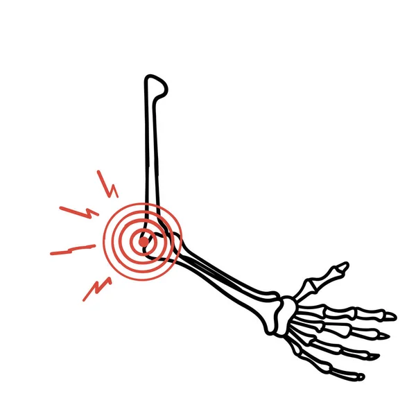 Illustration Douleur Articulaire Osseuse Gribouillée Main — Image vectorielle