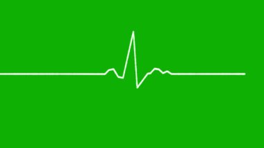 Beyaz frekans dalgaları yol hareketi grafikleri yeşil ekran arkaplanı