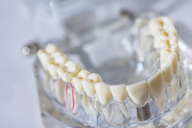 İnsan çenesi modeli. Seçici Odaklanma.