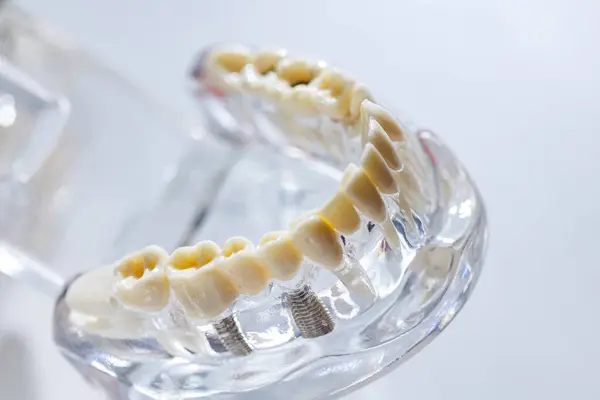 Teeth Education Model Shallow Dof — Stock Photo, Image