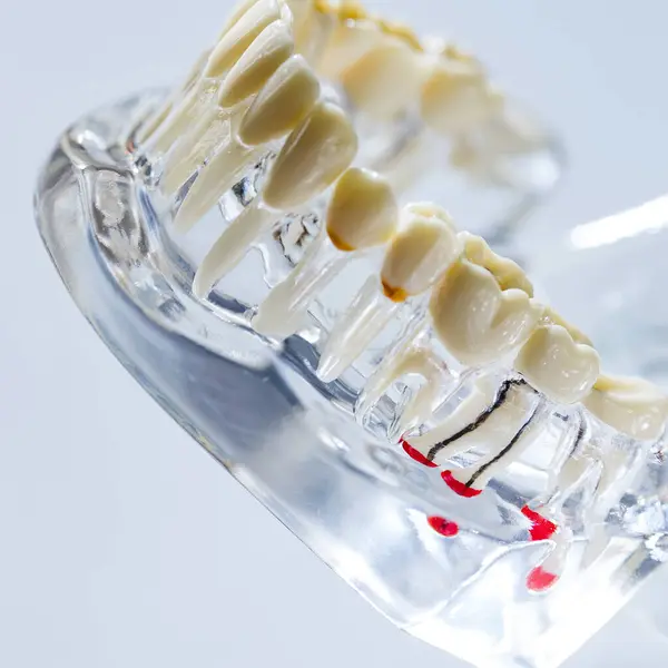 Teeth Education Model Shallow Dof — Stock Photo, Image