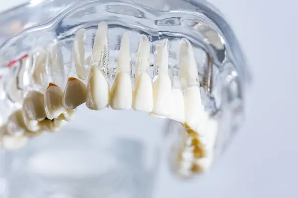 歯科インプラント 顎への人工歯根 歯科治療の根管 歯科医学を研究する歯科医のための歯モデル — ストック写真