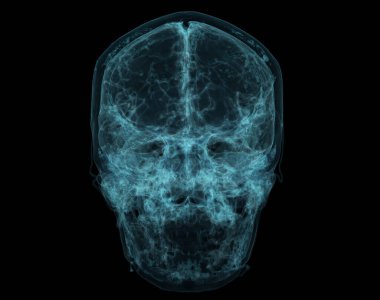 İnsan Kafatası, Beyin Taraması. Kafatasının içinde X-ışını görselleştirmesi. 3B Resim Hazırlama.