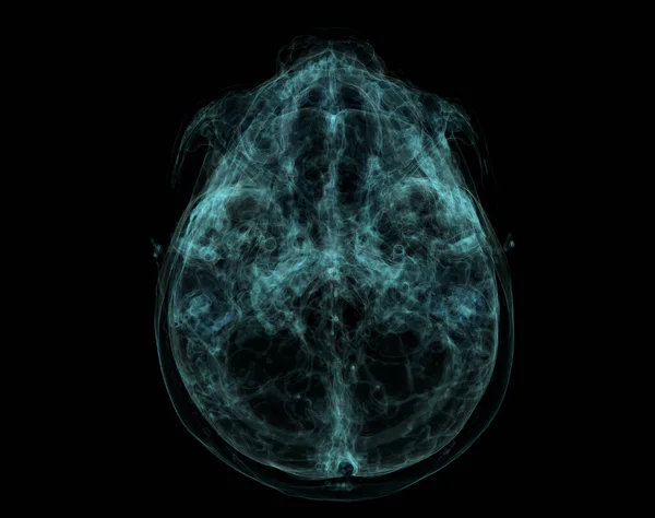 Base Humaine Crâne Cerveau Par Tomodensitogramme Visualisation Des Rayons Intérieur — Photo