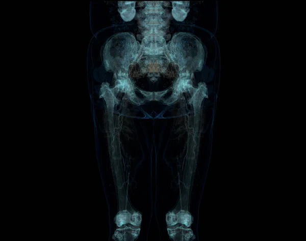 Сканування Нижньої Кінцівки Ілюстрація Кістки Стегнової Кістки Колінного Суглоба Ноги — стокове фото