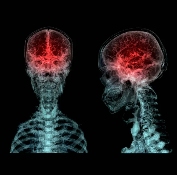 Тривимірна Медично Точна Ілюстрація Мозкової Артерії Голови — стокове фото